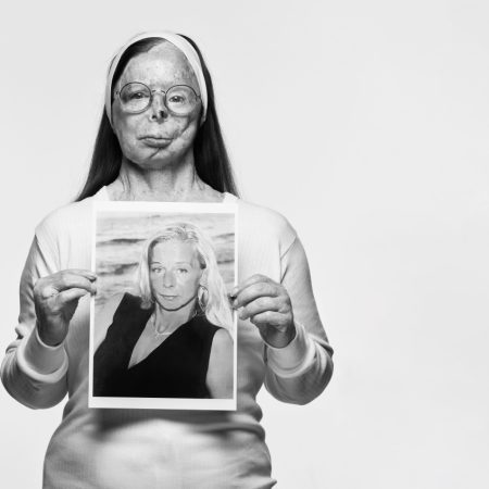 Bρετανός φωτογράφος αποτυπώνει τη δύναμη των γυναικών που επέζησαν από επίθεση με βιτριόλι