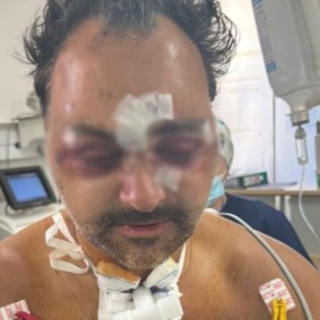 Άγριος ξυλ0δαρμός 49χρονου Ελληνοκαναδού τουρίστα από νταήδες Κρητικούς