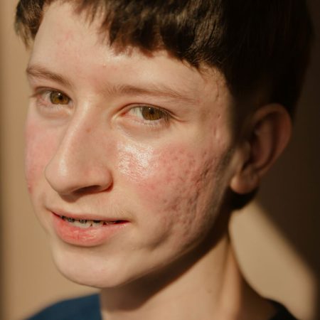 Πώς να μυήσεις το παιδί σου στο skincare routine