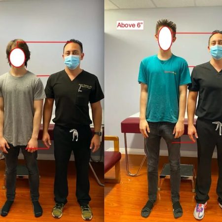 Θέλεις να ψηλώσεις: Στην Τουρκία σου σπάνε και ξανακολλάνε τα πόδια (κυριολεκτικά)