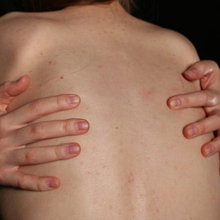 Γυναικείες θhλές: To σ3ξουαλικοπoιημένο σώμα τρώει ban στα social