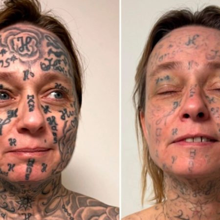 «Χτύπησε» 250 φορές το όνομά του στο σώμα της, για να ξέρουν ολοι οτι «του ανήκει»