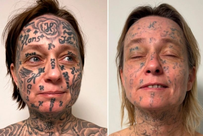 «Χτύπησε» 250 φορές το όνομά του στο σώμα της, για να ξέρουν ολοι οτι «του ανήκει»