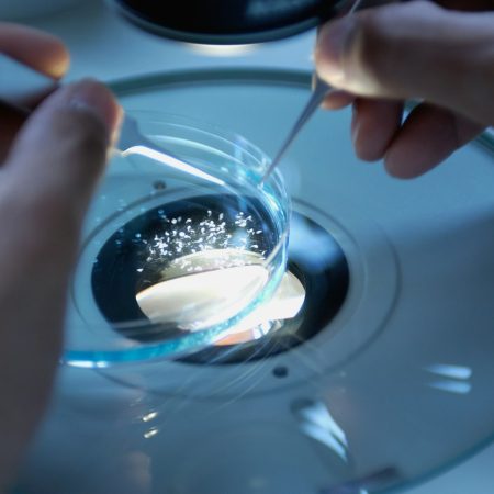 Για πρώτη φορά: Ανθρώπινο σπeρμα δημιουργήθηκε σε lab και χρησιμοποιήθηκε για έμβρυα