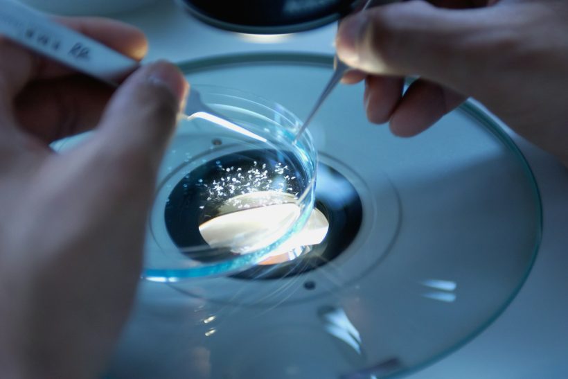 Για πρώτη φορά: Ανθρώπινο σπeρμα δημιουργήθηκε σε lab και χρησιμοποιήθηκε για έμβρυα