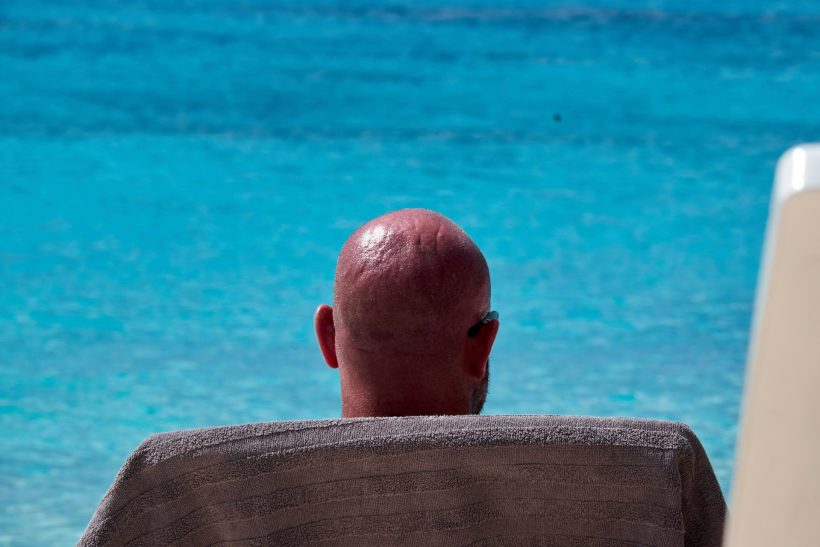 Φαλακροί του κόσμου ενωθείτε, γιατί η Κίνα ίσως και να βρήκε επιτέλους θεραπεία!